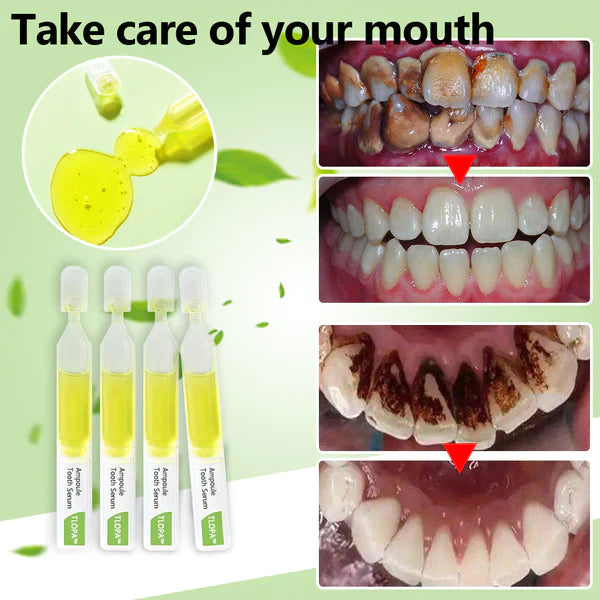š„TLOPA⢠Ampoule Toothpaste, Removal of tartar and plaque bacteria and various oral problems